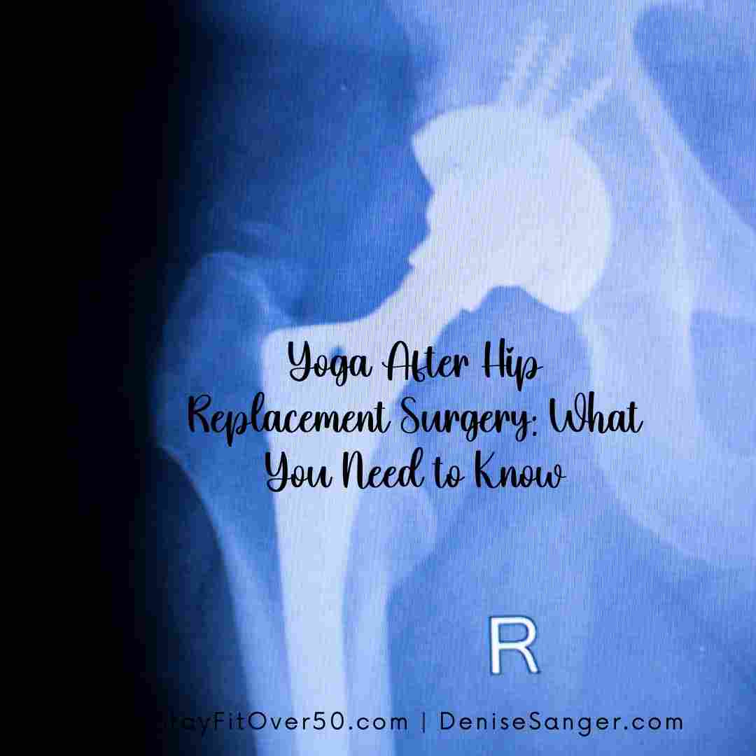 Yoga After Hip Replacement Surgery: What You Need to Know